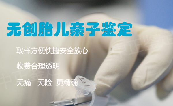 刚怀孕如何确定宝宝是谁的[长春],孕期亲子鉴定结果准吗