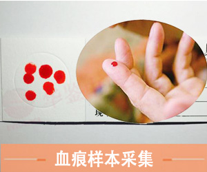血痕样本采集方法